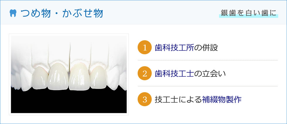 つめ物・被せ物